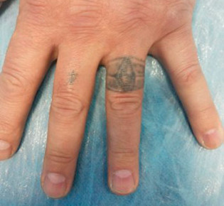 Значение татуировки перстень